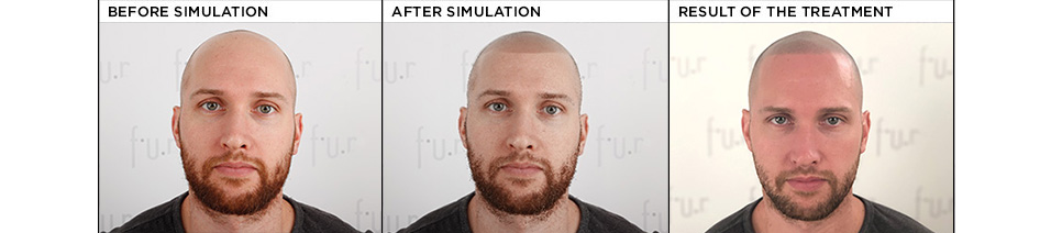 simulation FUR